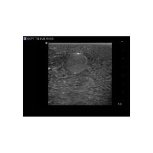 Breast Biopsy Ultrasound Training Model, EX-DEMO MODEL