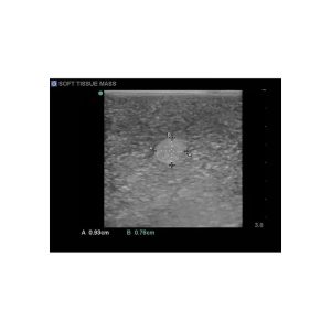 Breast Biopsy Ultrasound Training Model, EX-DEMO MODEL
