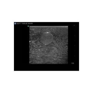 Breast Biopsy Ultrasound Training Model, EX-DEMO MODEL