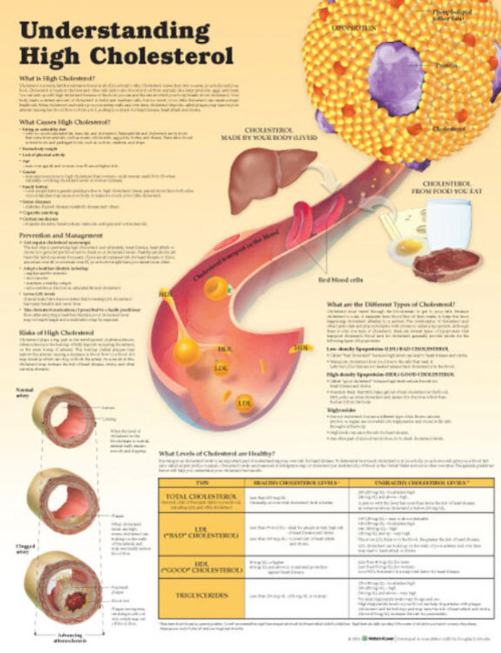 Understanding High Cholesterol