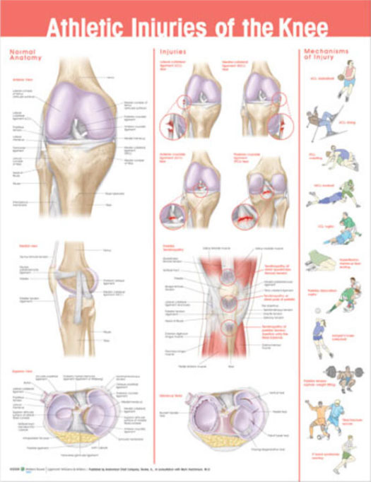 Athletic Injuries of the Knee Chart