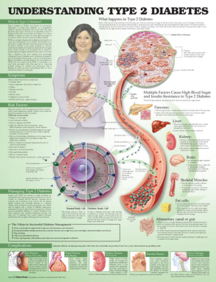 Understanding Type 2 Diabetes Chart