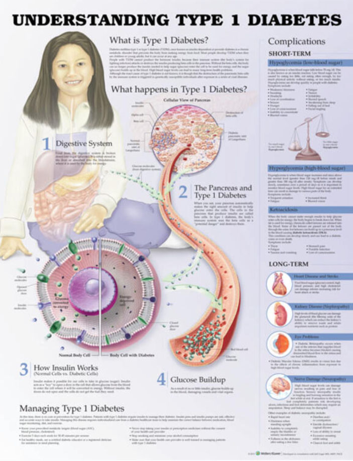 Understanding Type 1 Diabetes Chart