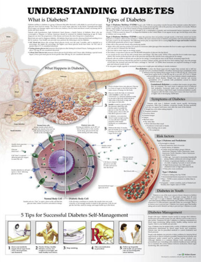 Understanding Diabetes Chart