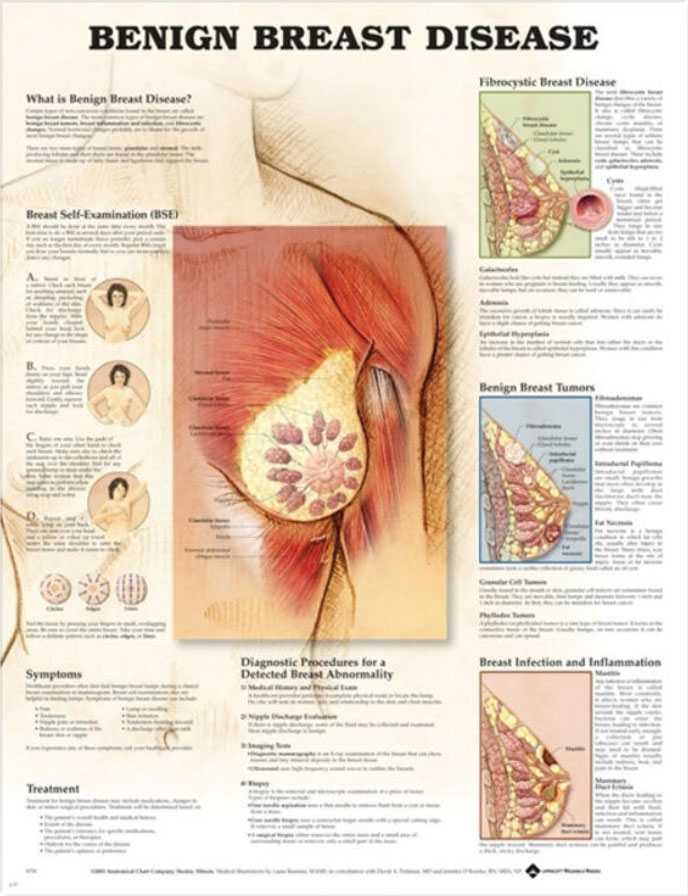 Benign Breast Disease Chart