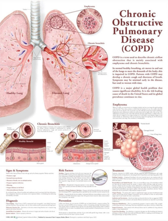 Chronic Obstructive Pulmonary Disease Chart