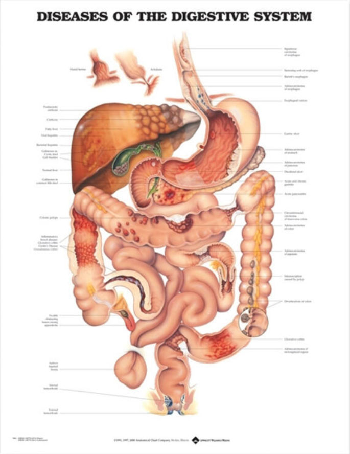 Diseases of Digestive System Chart