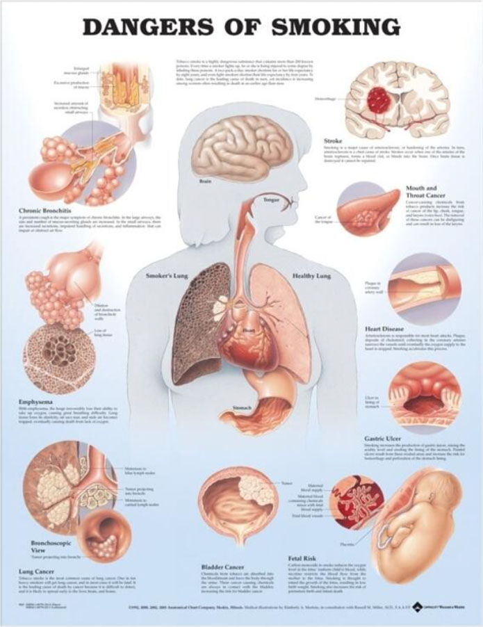 Dangers of Smoking Chart