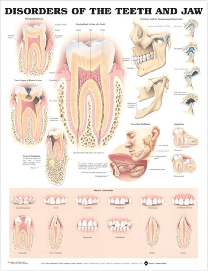 Disorders of the Teeth and Jaw Chart