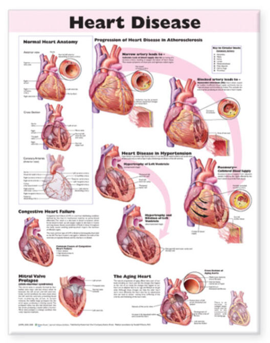 Heart Disease Chart
