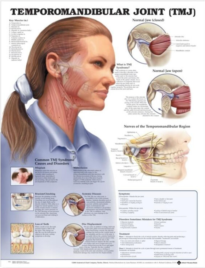 Temporomandibular Joint Syndrome Chart