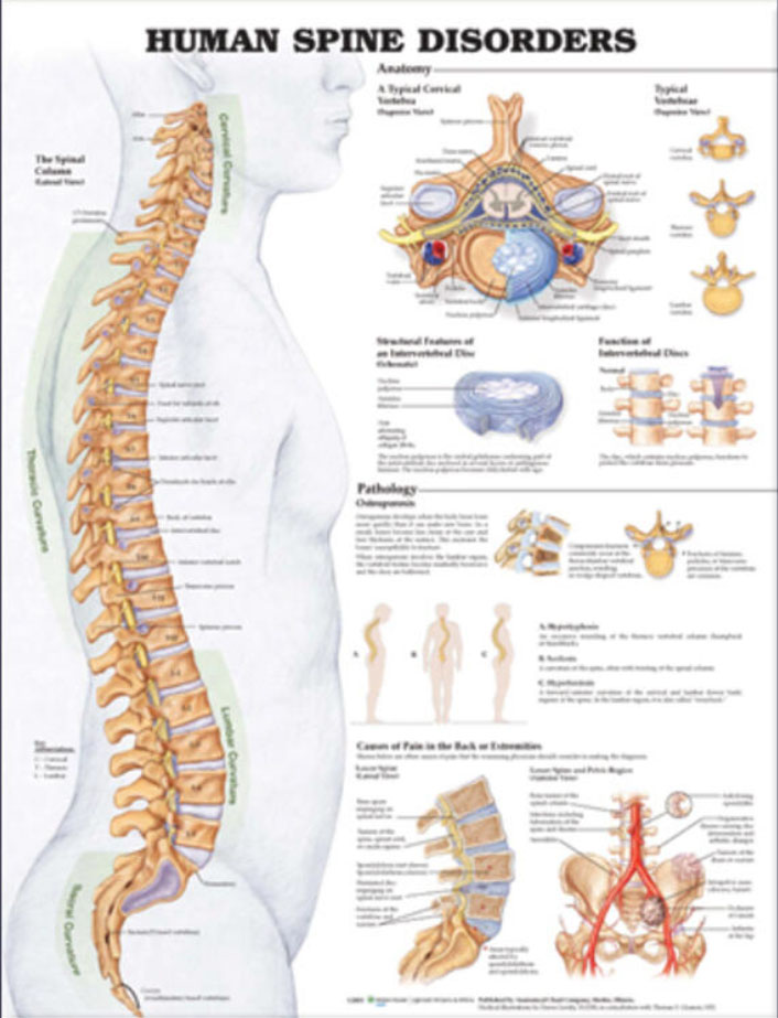Human Spine Disorders Chart