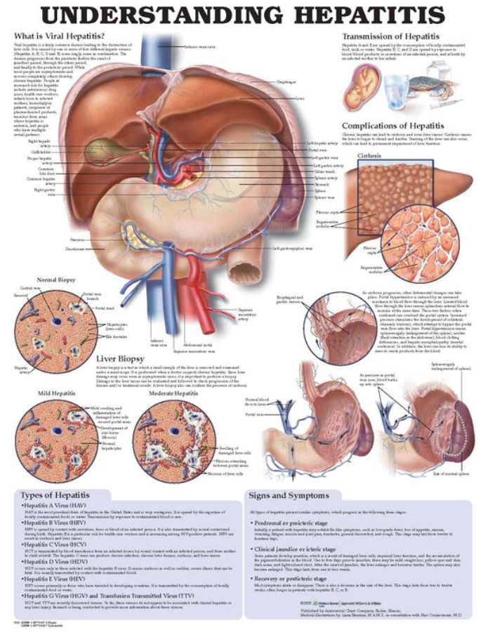 Understanding Hepatitis Chart