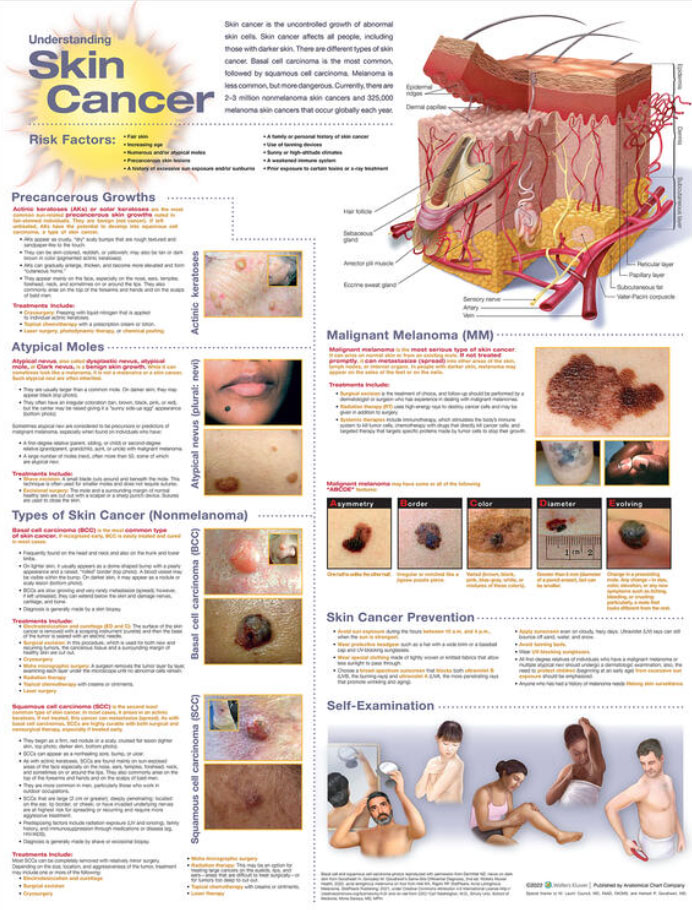 Understanding Skin Cancer Chart