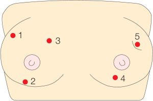 Breast Self-Examination Training Model