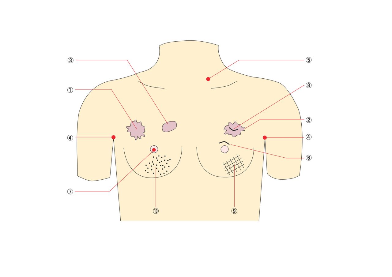 Breast Cancer Training Model