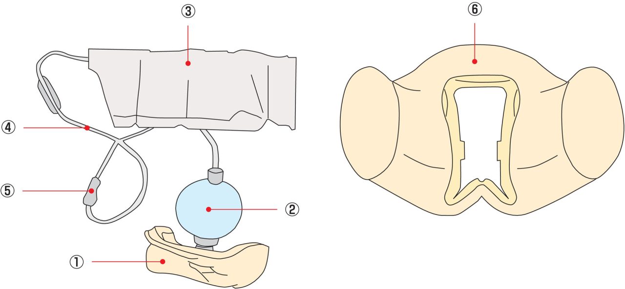 Urethral Catheterisation Model