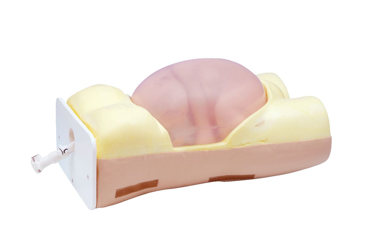 ECV (External Cephalic Version) Model