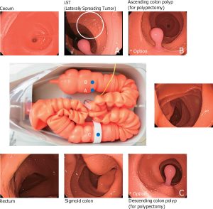 Colonoscopy (Lower GI Endoscopy) Simulator Type II