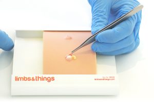 Sebaceous Cyst Pad, Light
