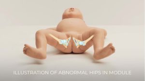 Infant Hip Examination Trainer, Light