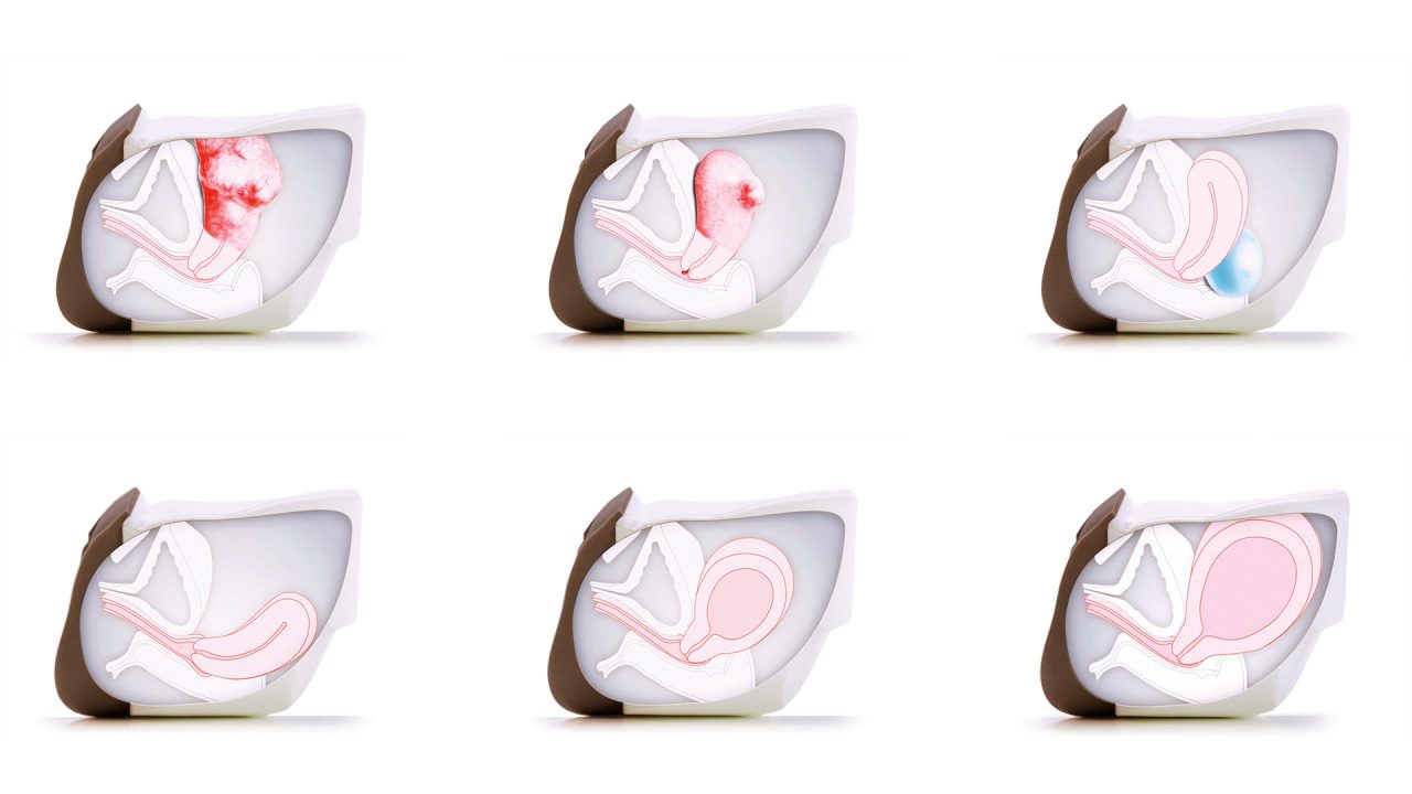 Advanced Clinical Female Pelvic Trainer (CFPT) Mk 3, Dark