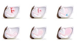 Advanced Clinical Female Pelvic Trainer (CFPT) Mk 3, Dark