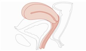 CFPT Mk 3 Module 1: Normal Nulliparous Cervix, Dark