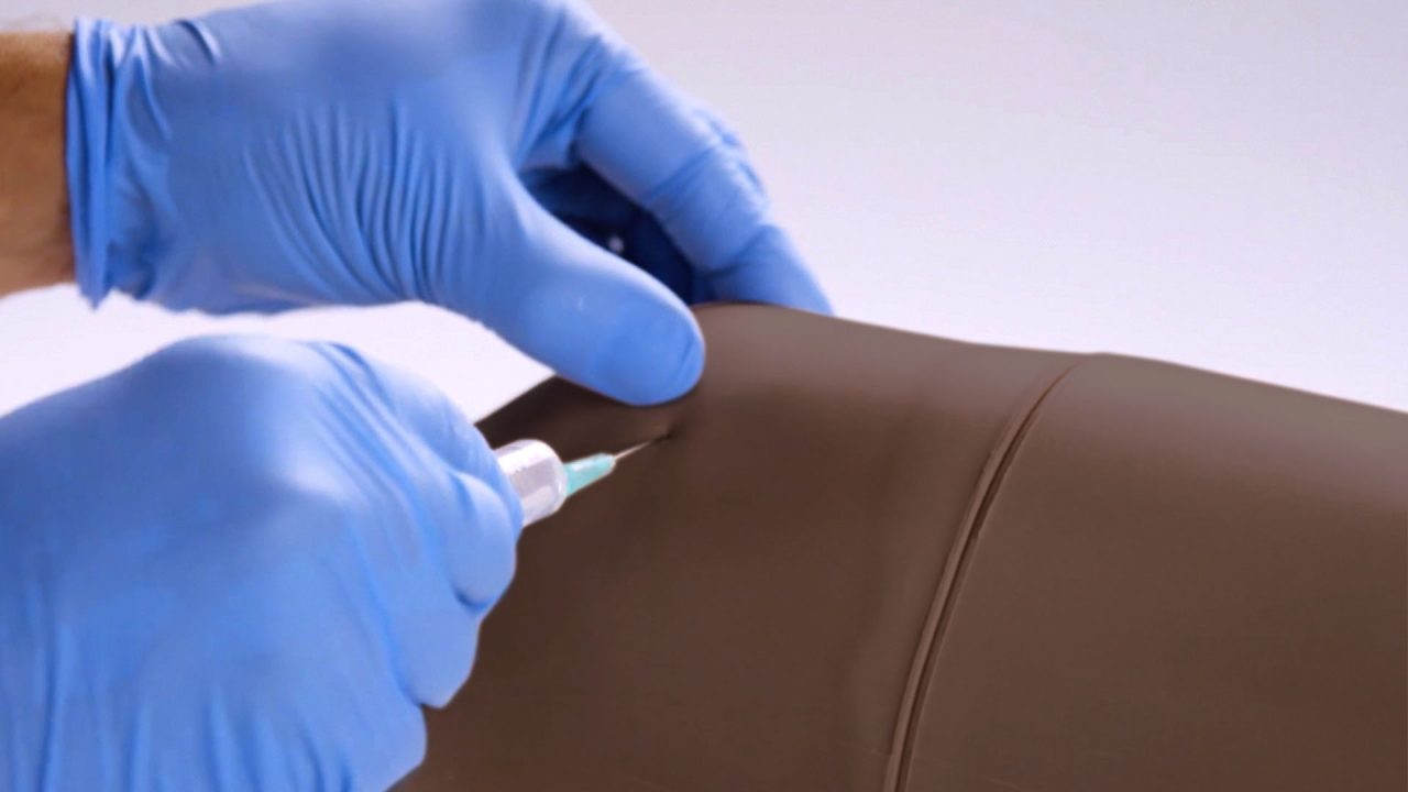 Knee Aspiration & Injection Trainer With Ultrasound Capabilities, Dark
