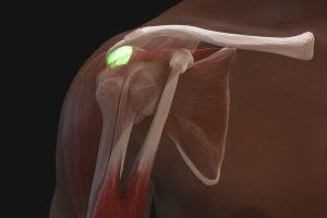 Shoulder Injection Trainer Palpation Guided with Android Tablet, Light