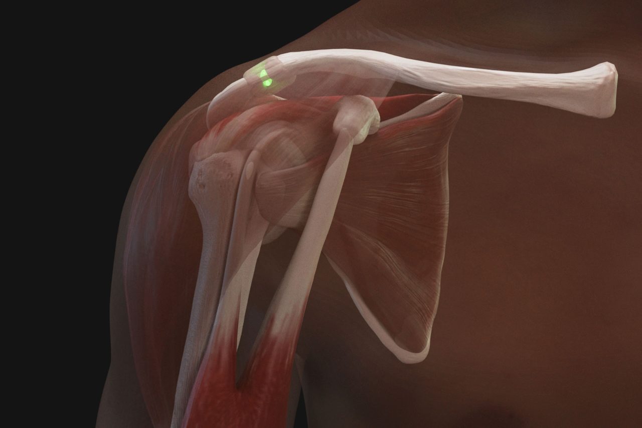 Shoulder Injection Trainer Palpation Guided with Android Tablet, Light