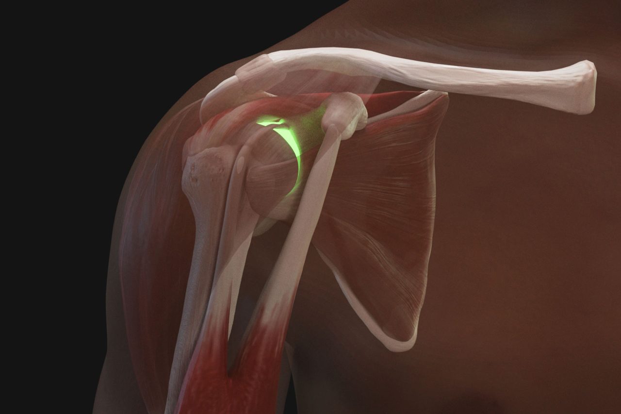 Shoulder Injection Trainer Palpation Guided with Android Tablet, Light