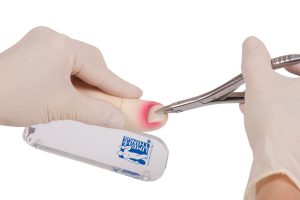 Ingrowing Toenail Trainer, Light