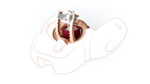 Prompt Flex Cervial Dilation & Effacement Module, Light