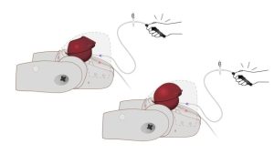 Prompt Flex Postpartum Haemorrhage Kit, Dark