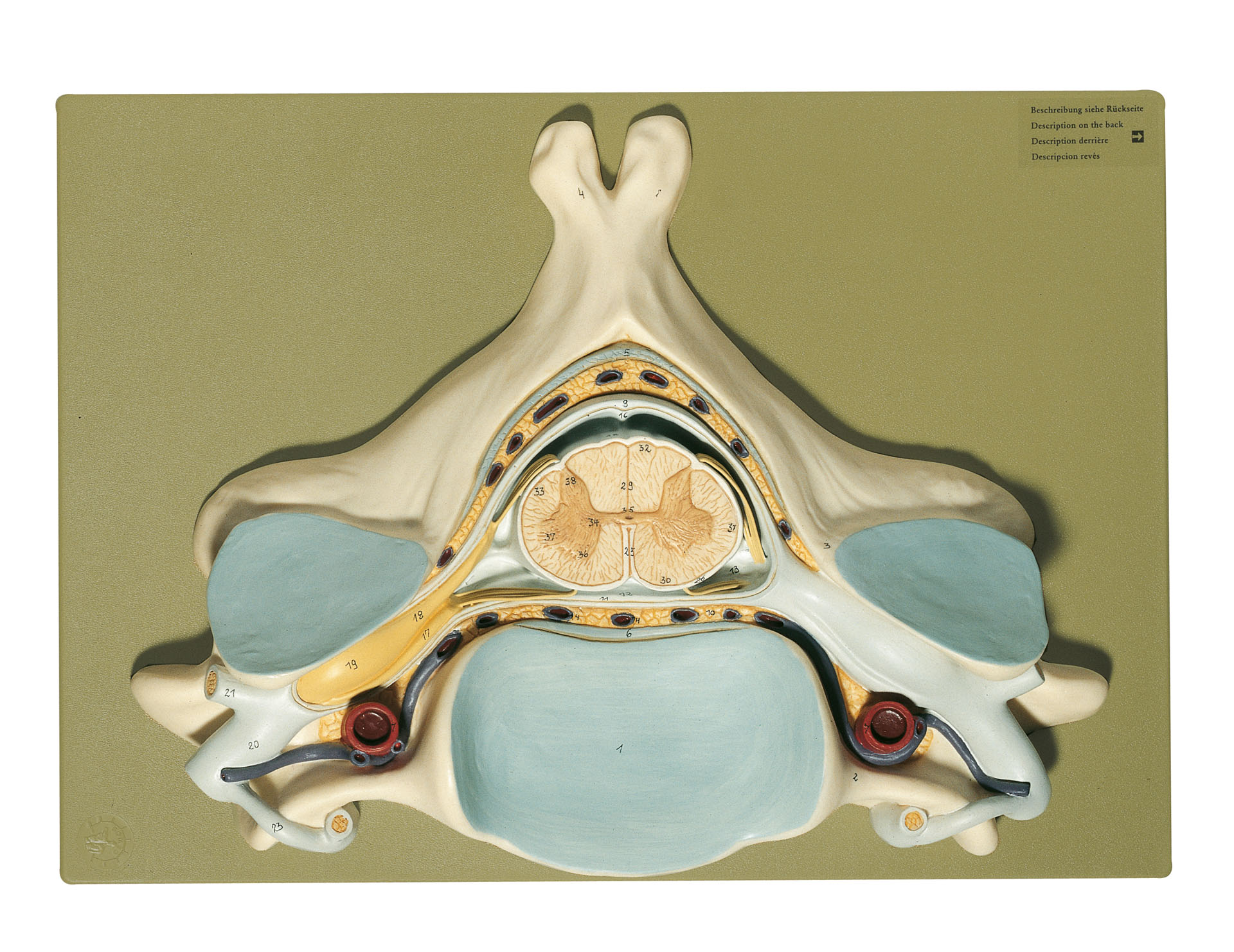 Fifth Cervical Vertebra