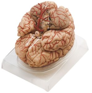 Brain With Arteries - Separates Into 9 Parts