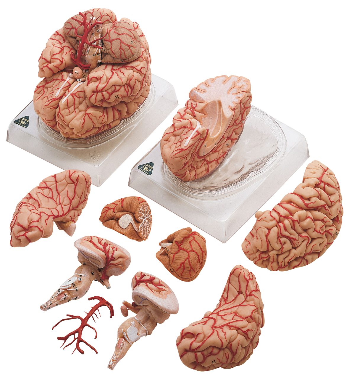 Brain With Arteries - Separates Into 9 Parts