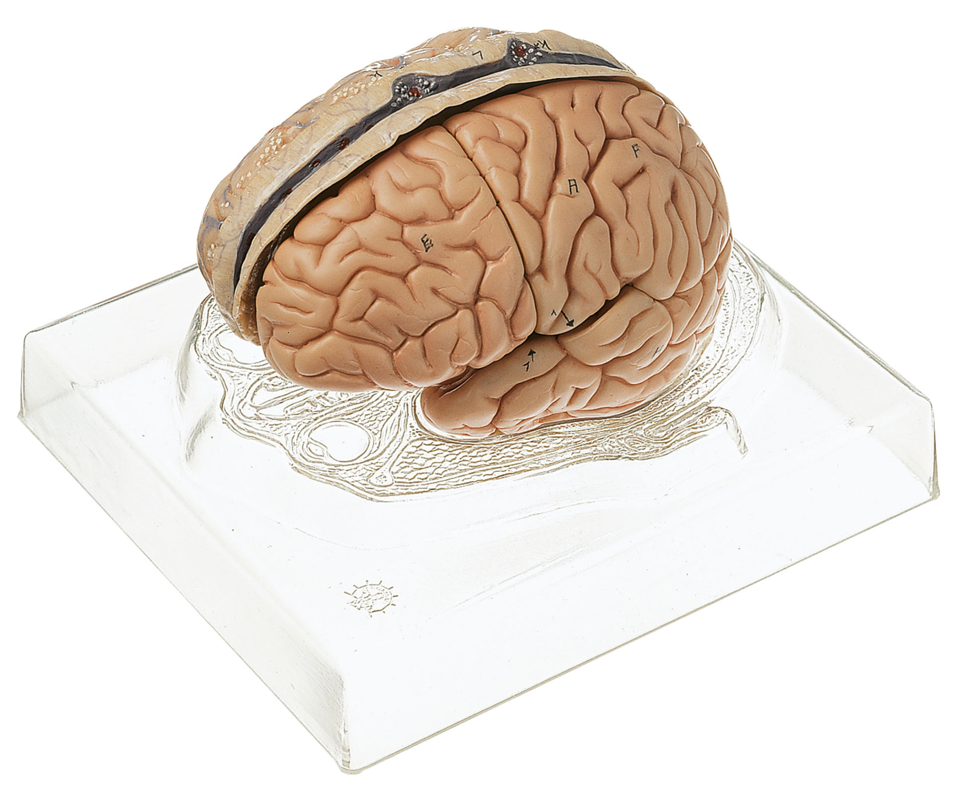 Model of Brain – Separates Into 6 Parts