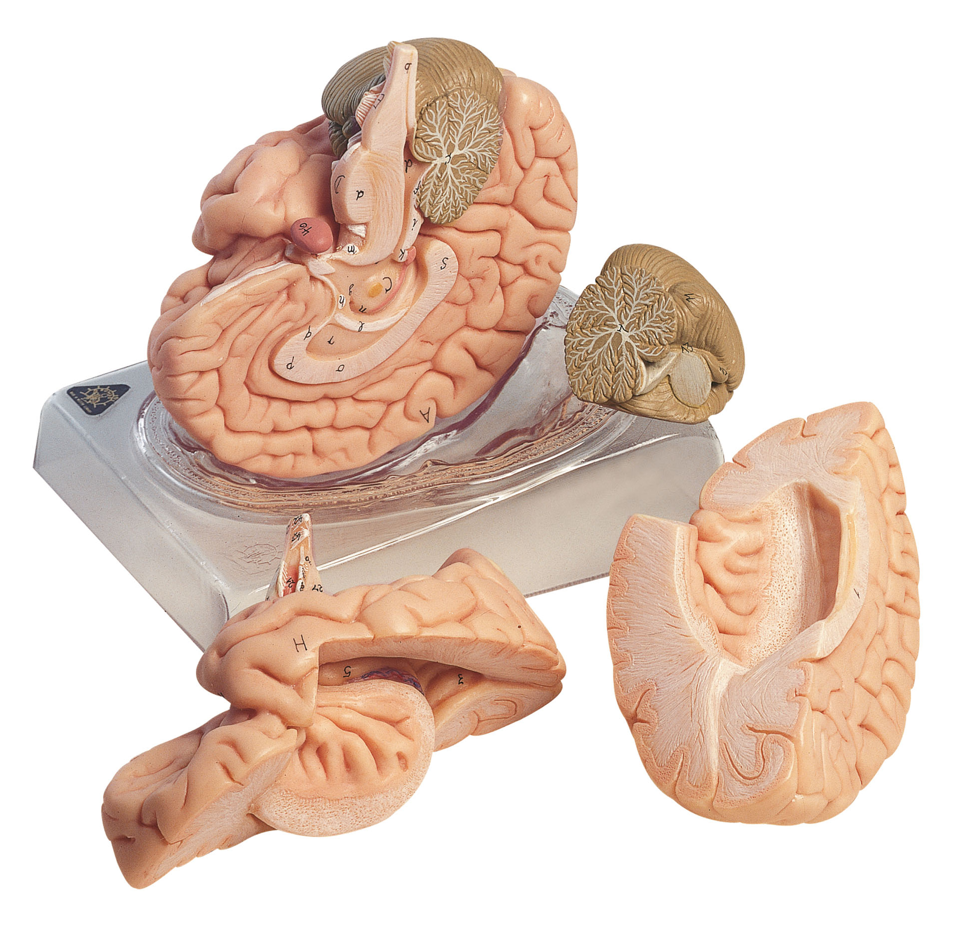 Brain – Separates Into 4 Parts