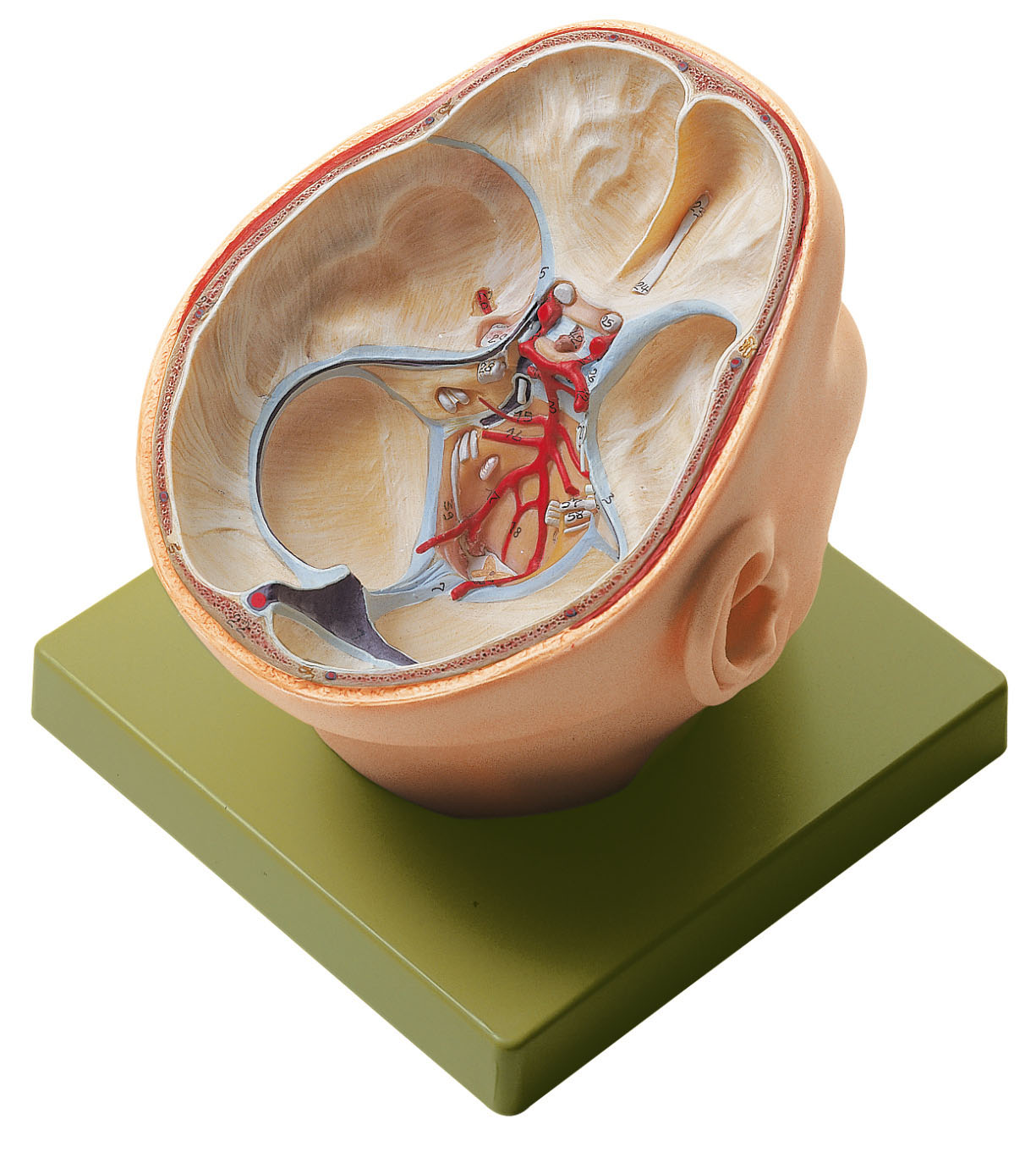 Situs of the Base of the Skull, Light