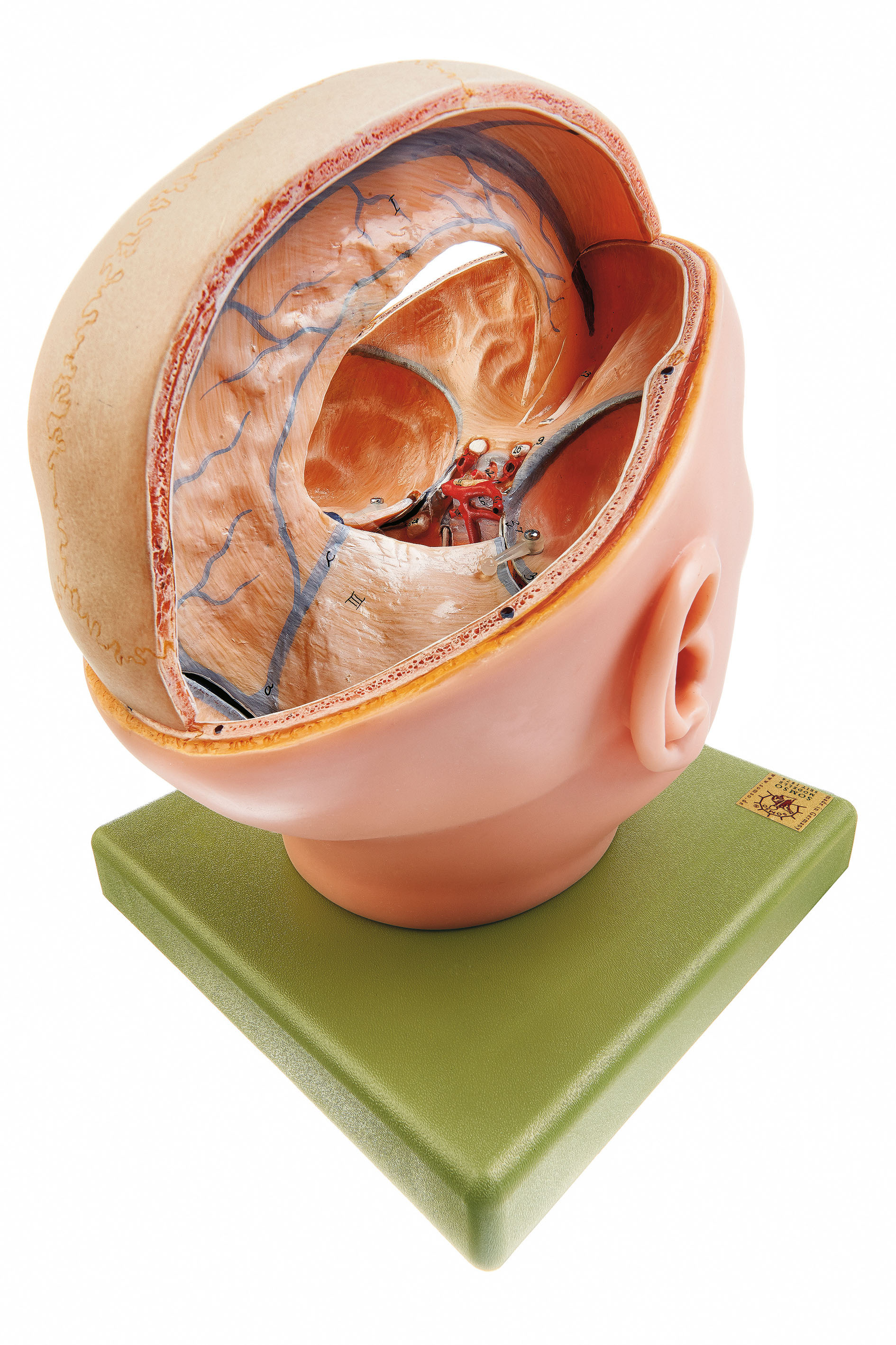 Proportions of the Dura Mater, Light