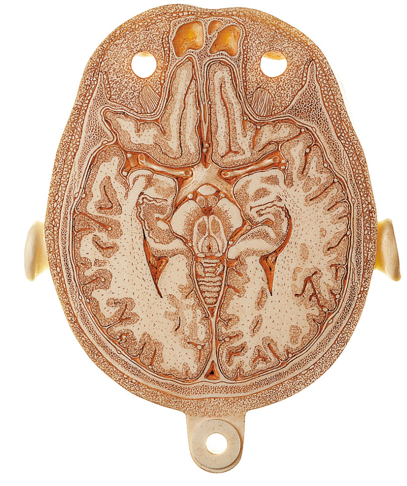 Anatomical Sectional Model of the Head (Combined With Corresponding Mr-figures)