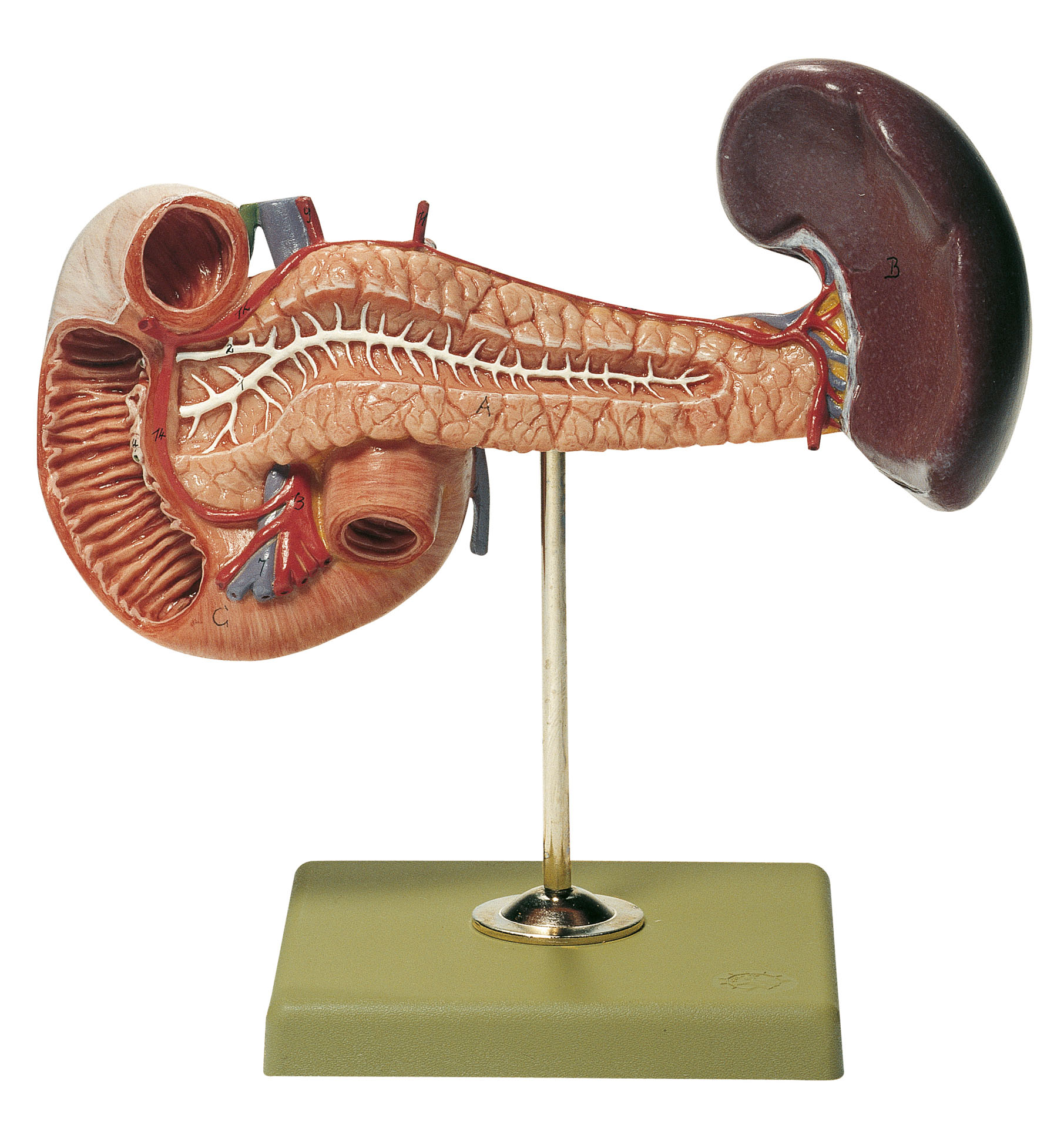 Pancreas With Spleen and Duodenum