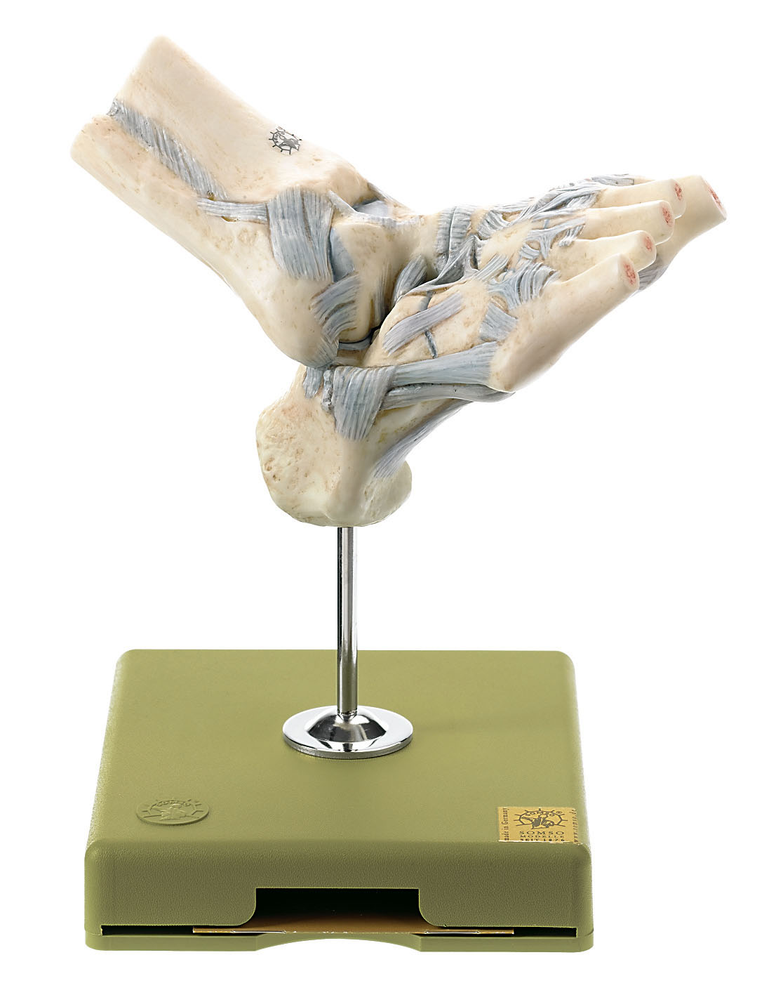 Ligaments of the Ankle With Open Talonavicular Joint