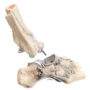 Ligaments of the Ankle With Open Talonavicular Joint