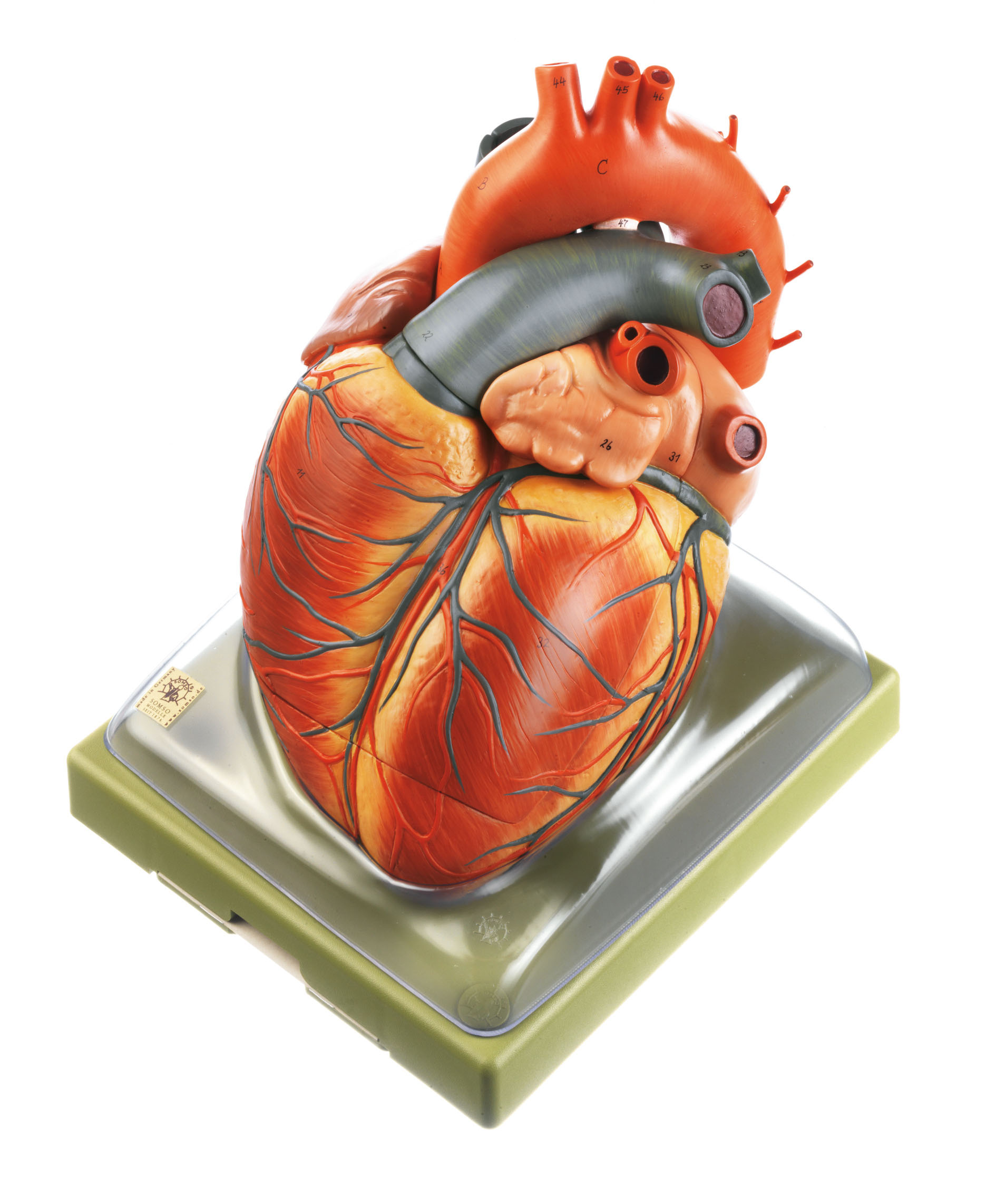 Heart – Separates Into 3 Parts