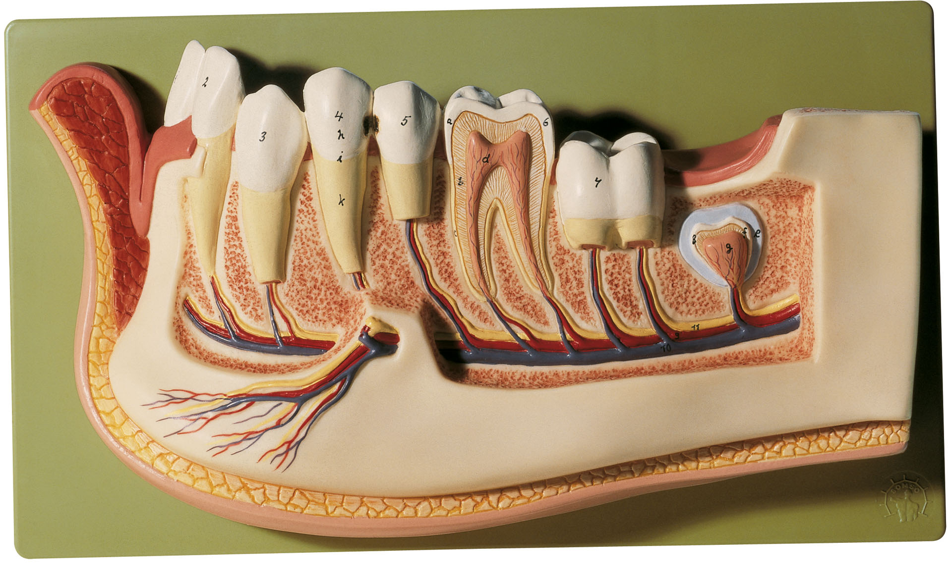 Lower Jaw of a 12-Year-Old, Light
