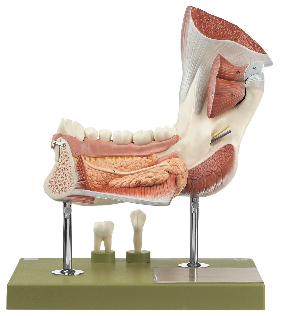 Right Lower Jaw With Muscles
