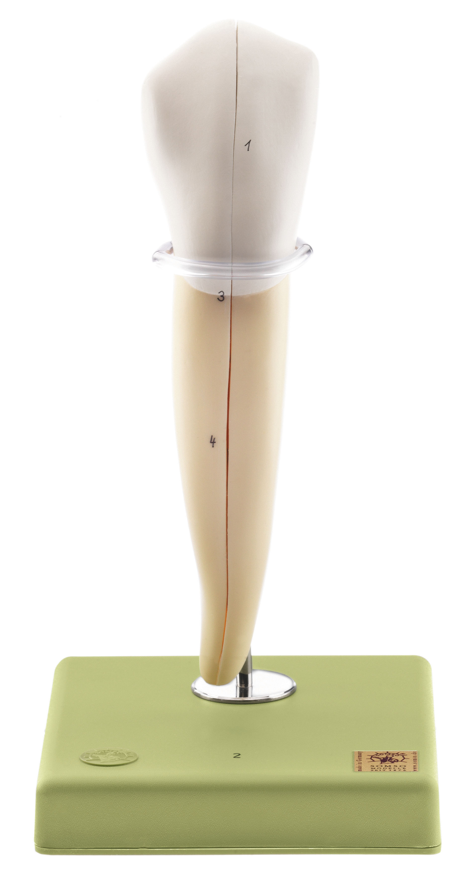 Lower Canine